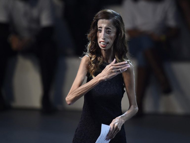 FamousPeopleFacts - Lizzie Velasquez